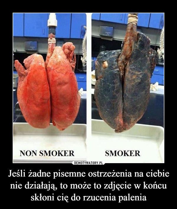 Jeśli żadne pisemne ostrzeżenia na ciebie nie działają, to może to zdjęcie w końcu skłoni cię do rzucenia palenia