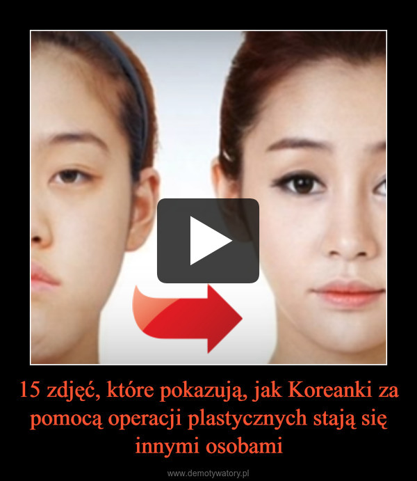 15 zdjęć, które pokazują, jak Koreanki za pomocą operacji plastycznych stają się innymi osobami