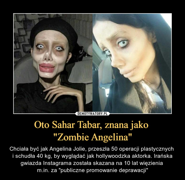 Oto Sahar Tabar, znana jako "Zombie Angelina" – Chciała być jak Angelina Jolie, przeszła 50 operacji plastycznych i schudła 40 kg, by wyglądać jak hollywoodzka aktorka. Irańska gwiazda Instagrama została skazana na 10 lat więzienia m.in. za "publiczne promowanie deprawacji" 