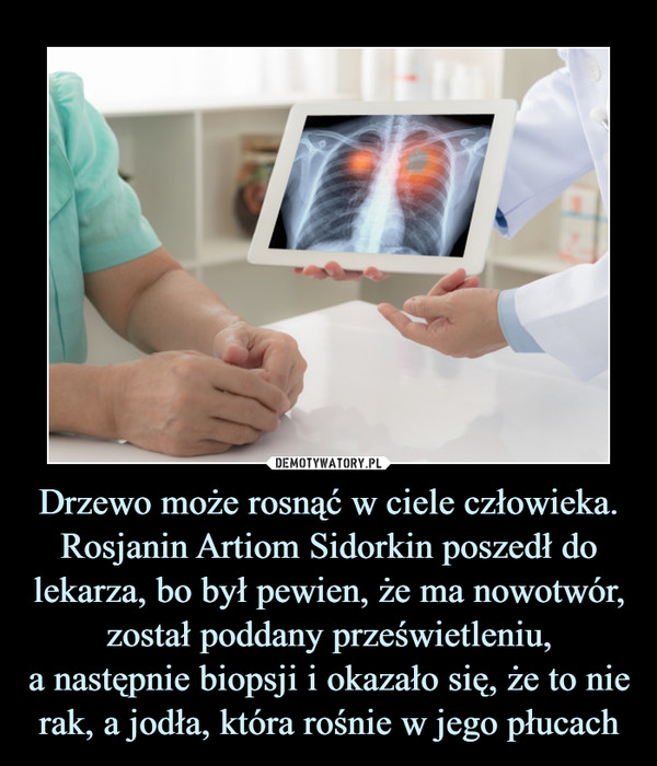 Drzewo może rosnąć w ciele człowieka. Rosjanin Artiom Sidorkin poszedł do lekarza, bo był pewien, że ma nowotwór, został poddany prześwietleniu,
a następnie biopsji i okazało się, że to nie rak, a jodła, która rośnie w jego płucach