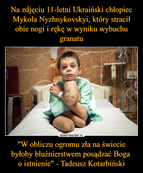 Na zdjęciu 11-letni Ukraiński chłopiec Mykola Nyzhnykovskyi, który stracił obie nogi i rękę w wyniku wybuchu granatu "W obliczu ogromu zła na świecie byłoby bluźnierstwem posądzać Boga 
o istnienie" - Tadeusz Kotarbiński